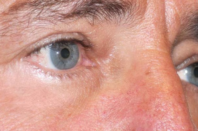 Close up of a man's eye