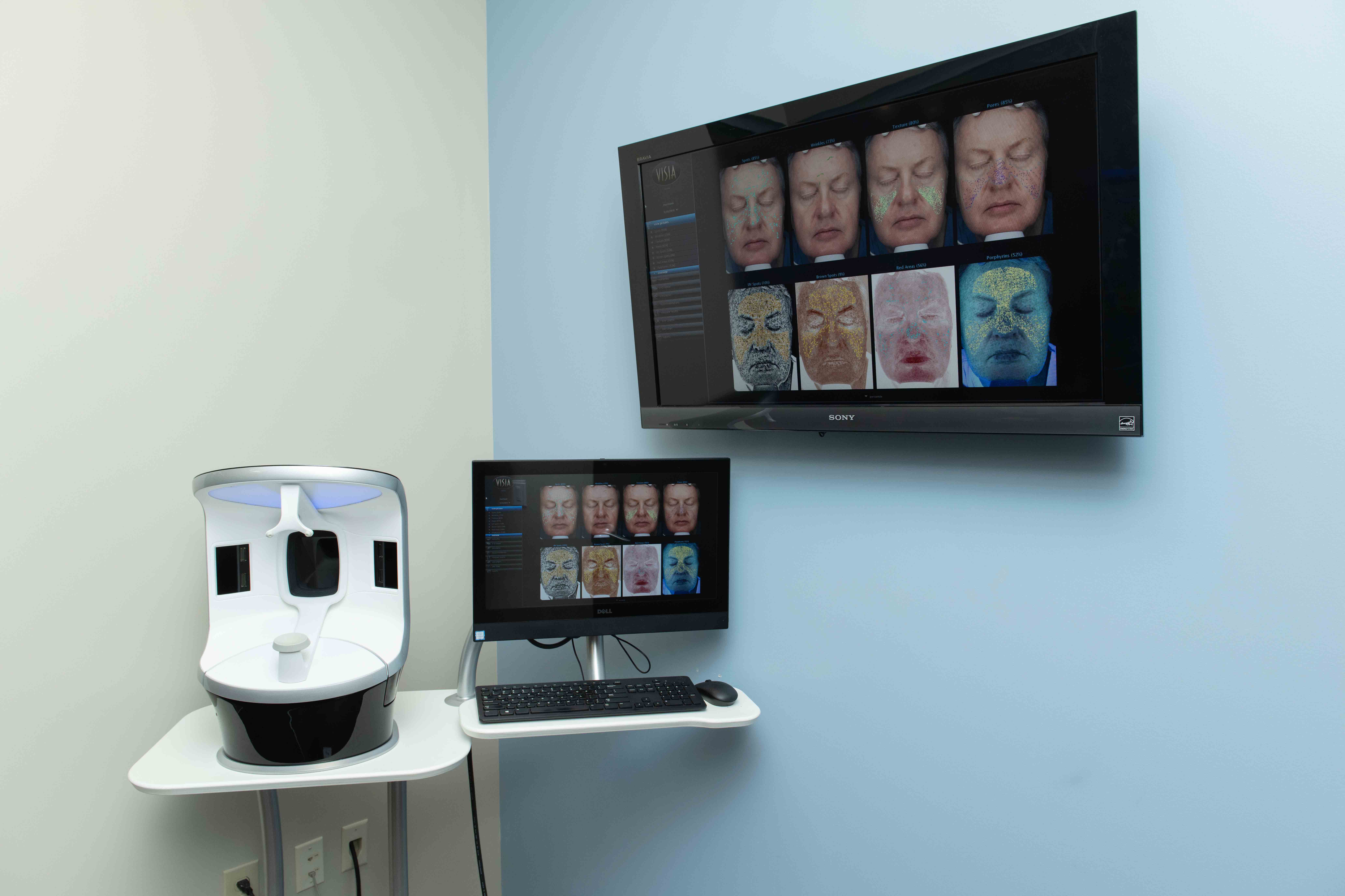 Digital imaging station in an exam room of Mentor Plastic Surgery and MedSpa