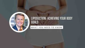 Dr. Paul Vanek shares his insight on Liposuction: Achieving Your Body Goals