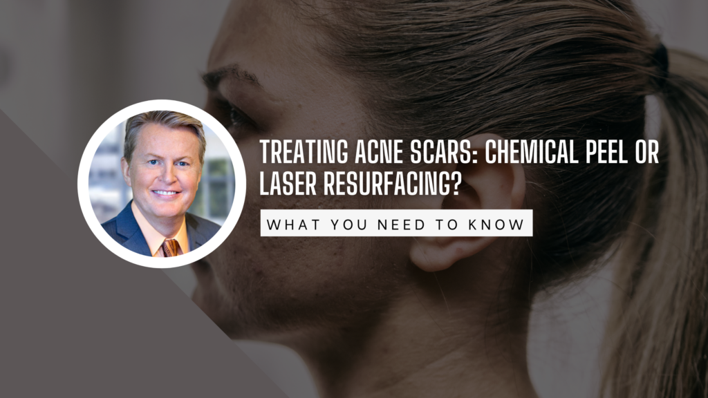 chemical peel vs laser resurfacing