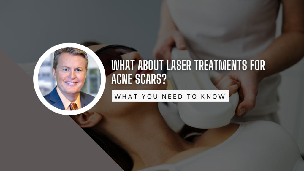 Laser Treatments for Acne Scars