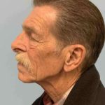 Eyelid Surgery Before & After Patient #11631